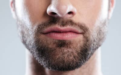 Trasplante de barba y bigote