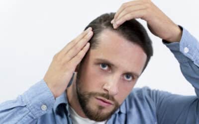 ¿Alopecia o Calvicie?