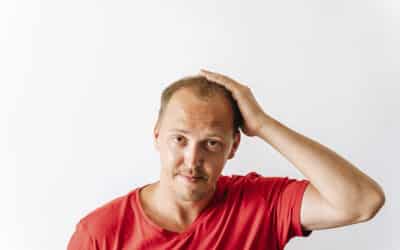 Implante de cabello: La solución para la pérdida del cabello