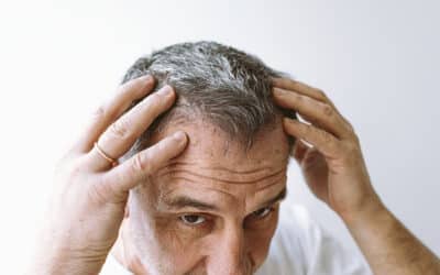 ¿Cuál es el precio de un implante de cabello?