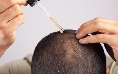 Clínica para el cabello: Recupera la salud capilar